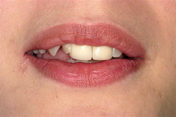 image of before restoration